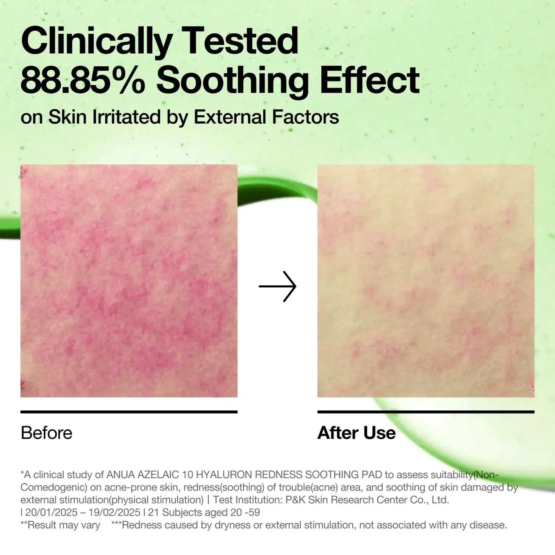 Online Acid 10 Hyaluron Redness Soothing Pad Hauptzutat|Toner Pads