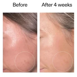 Advanced Retinoid Serum Vegan Pflege|Problemlösende Seren