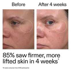 Advanced Retinoid Serum Vegan Pflege|Problemlösende Seren