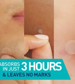 New Anti-Blemish Patches Hauptzutat|Hautprobleme
