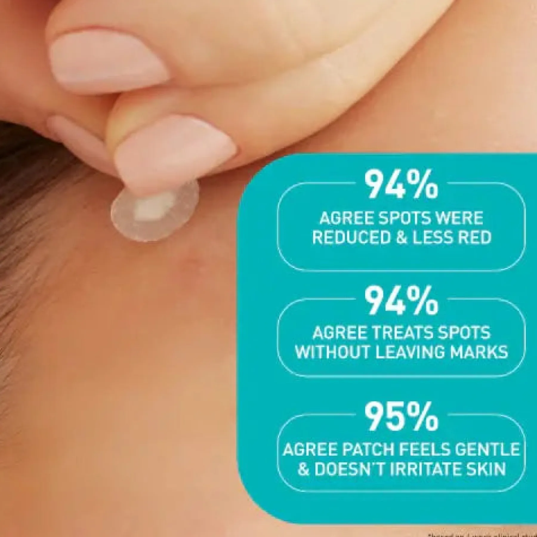 New Anti-Blemish Patches Hauptzutat|Hautprobleme
