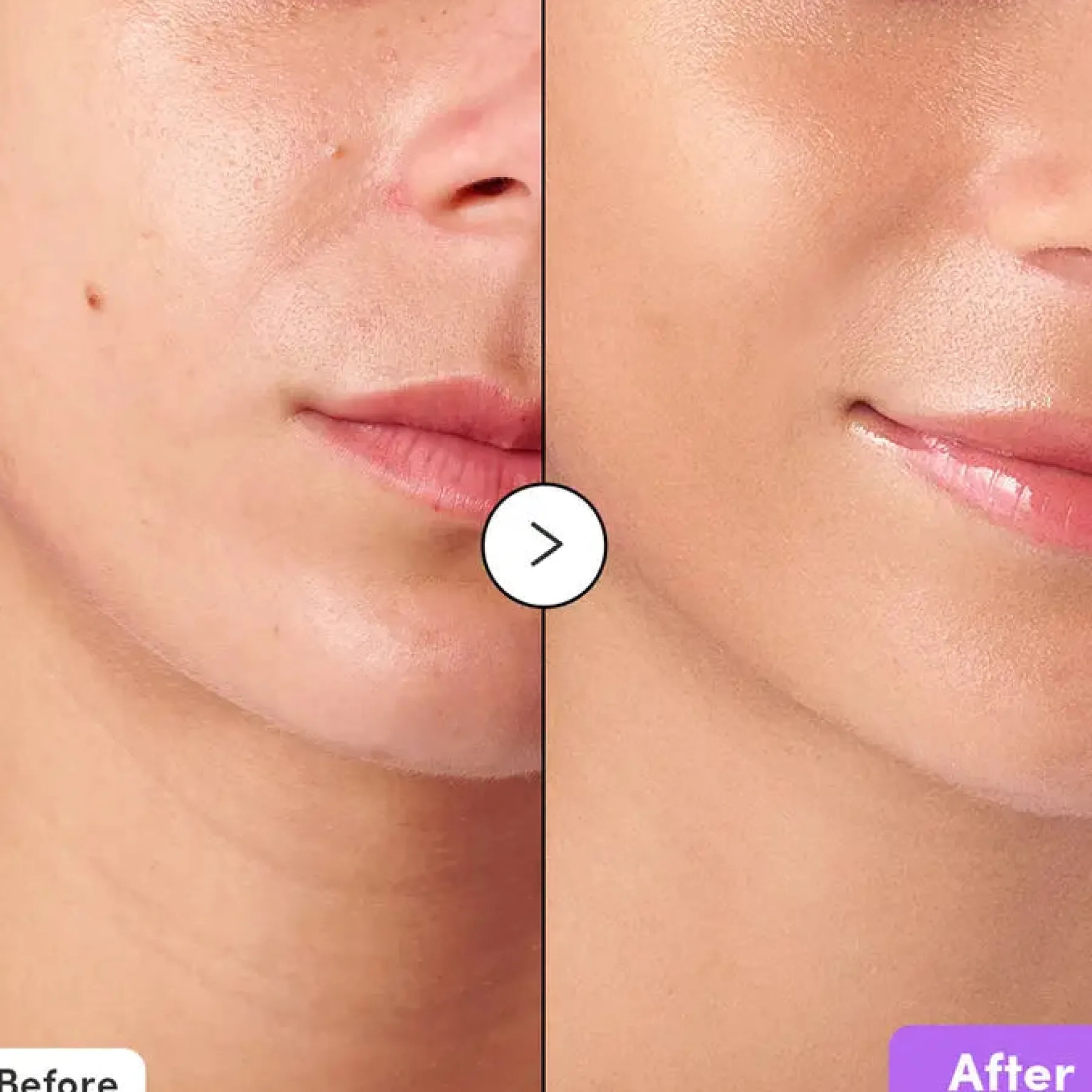 New Bakuchiol Plumping Capsule Toner Alle Korean Skincare|Toners