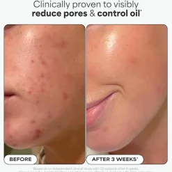 Online BHA Liquid Exfoliant 30 ml. Vegan Pflege|Gesichtsmasken