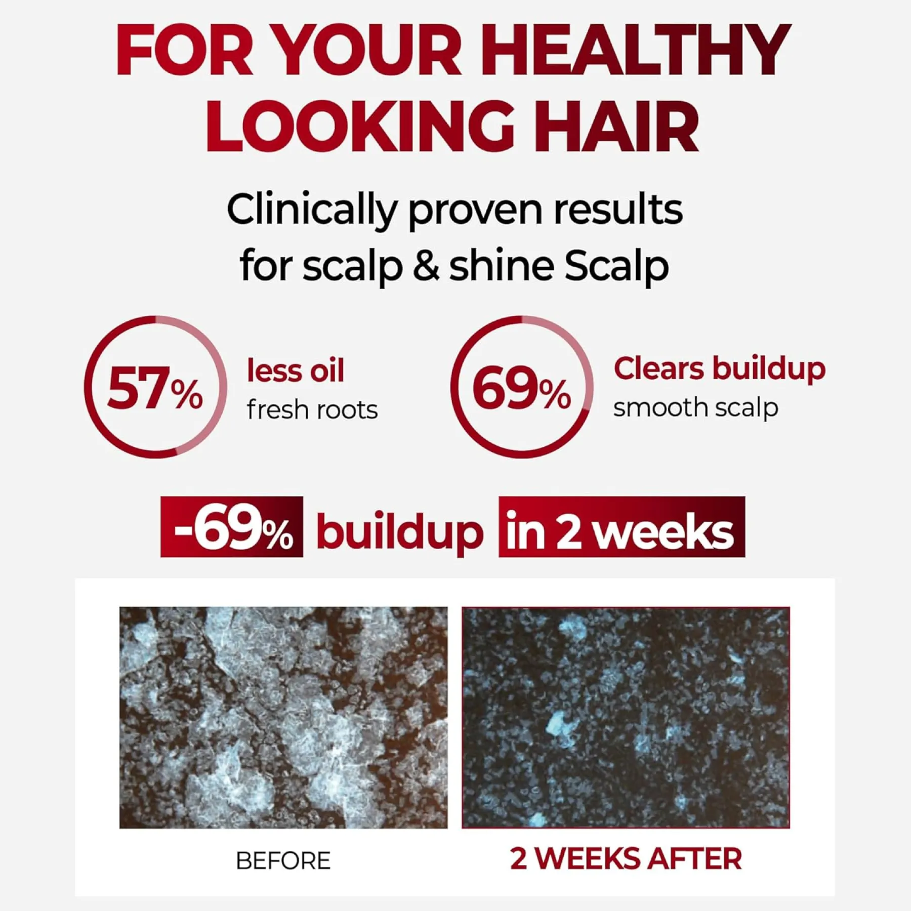 New Caffeine Shampoo Cherry Blossom Korean Haarpflege|Shampoo