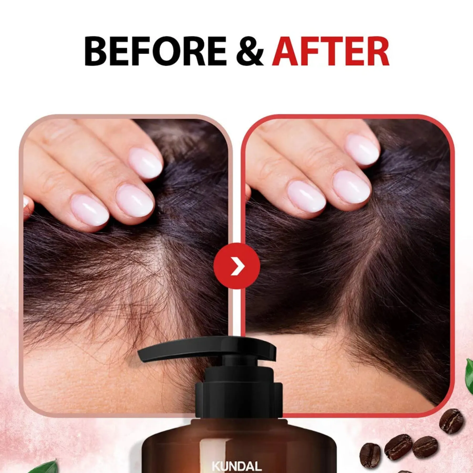 New Caffeine Shampoo Cherry Blossom Korean Haarpflege|Shampoo