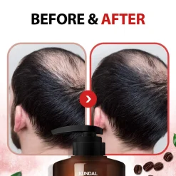 Hot Caffeine Shampoo White Musk Korean Haarpflege|Hauptzutat