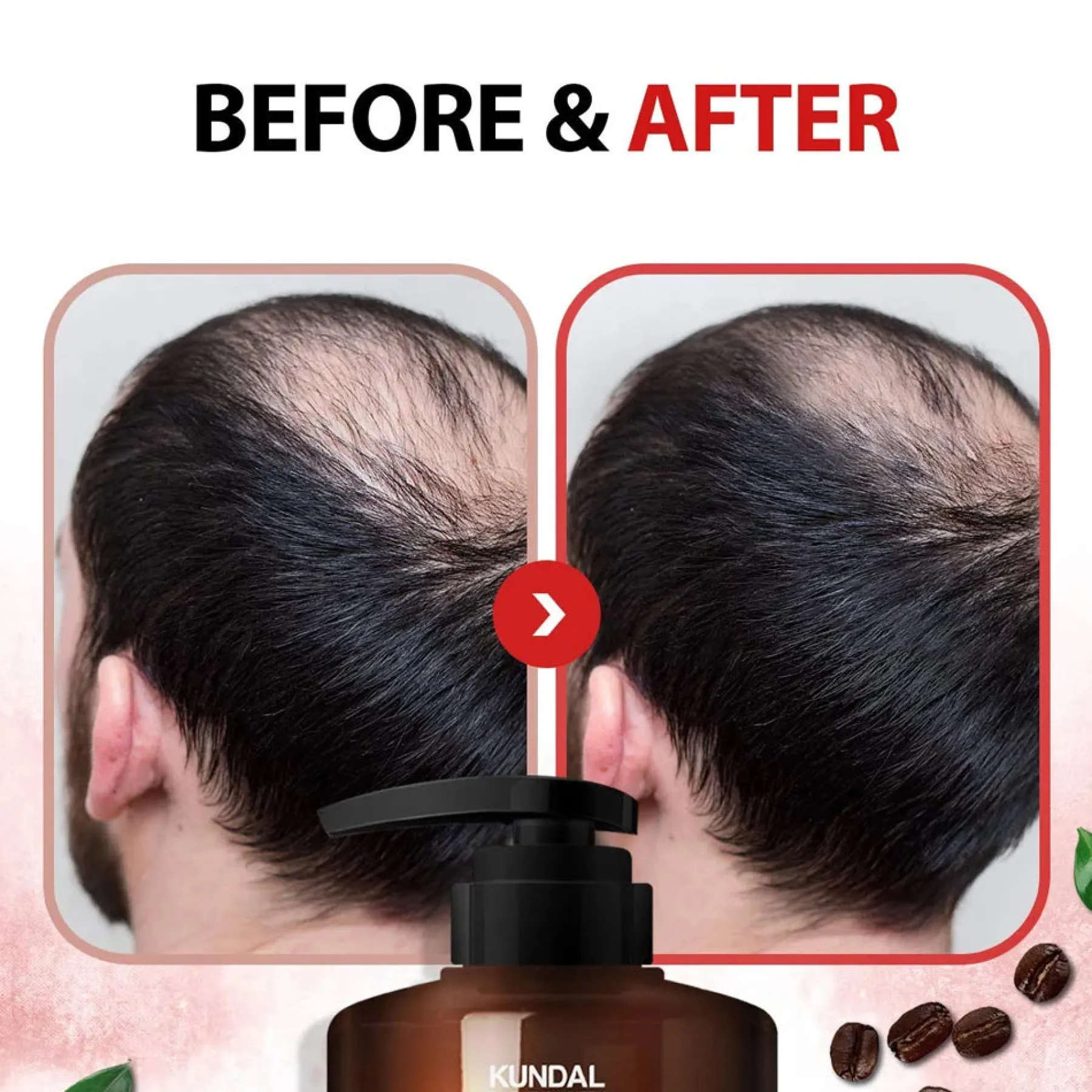 Hot Caffeine Shampoo White Musk Korean Haarpflege|Hauptzutat