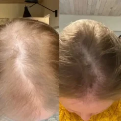 Hot Collagen Tripeptide & Vitamine C Kollagen|Hauptzutat