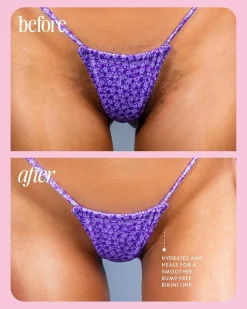 Hot Cooka Ingrown Concentrate Everything Shower|Hauptzutat