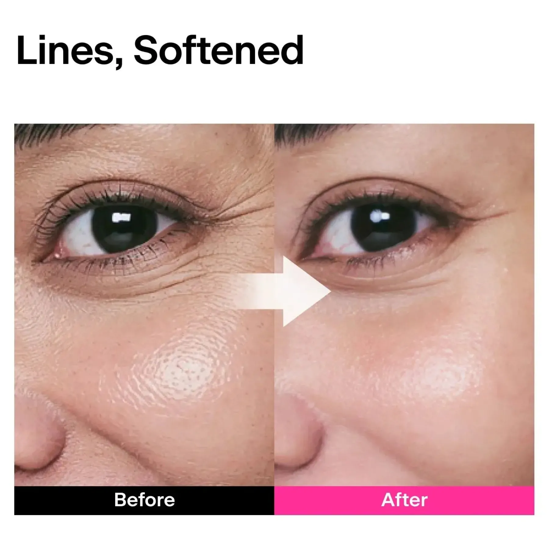 Best CPR Triple-synergy Wrinkle Care Serum Hauptzutat|Problemlösende Seren