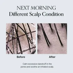 Damage Therapy Scalp Scaling Ampoule Hair Growth|Korean Haarpflege