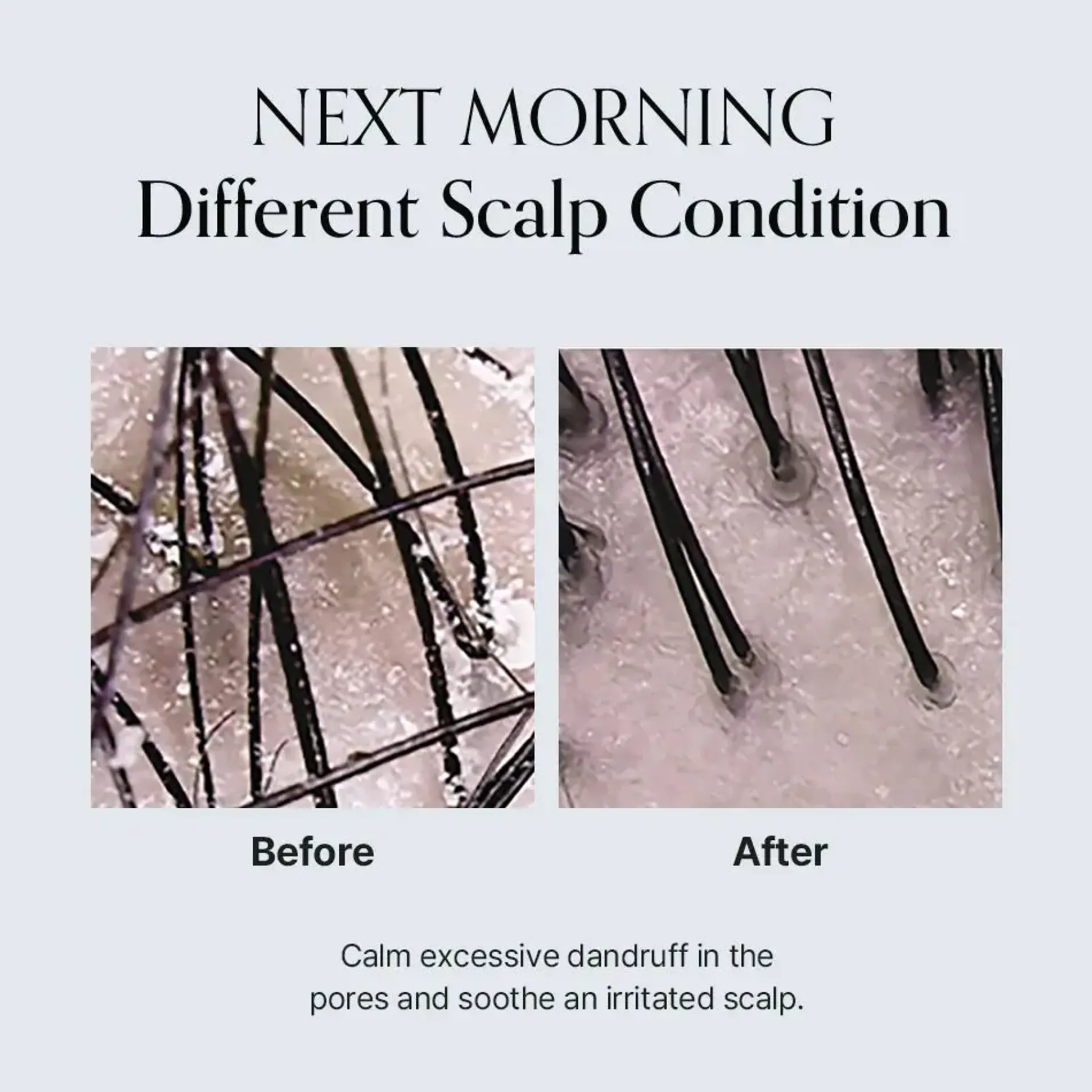 Damage Therapy Scalp Scaling Ampoule Hair Growth|Korean Haarpflege