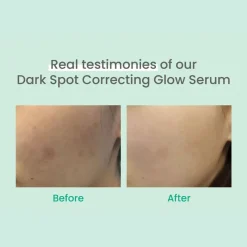 Discount Dark Spot Correcting Glow Serum 20 ml Aufhellendes Serum|Problemlösende Seren