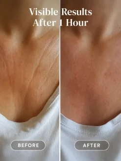 Online Décolleté Pad Hyaluron Hauptzutat|Hautprobleme
