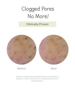 Online Deep Pore Cleansing Soda Foam Alle Korean Skincare|Reinigungsmittel