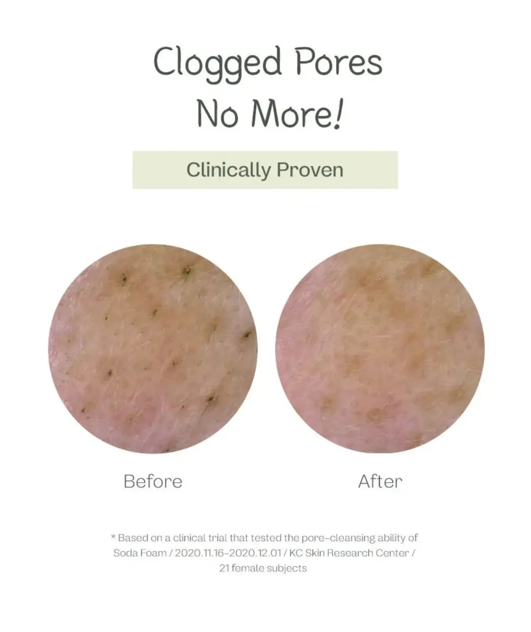 Online Deep Pore Cleansing Soda Foam Alle Korean Skincare|Reinigungsmittel