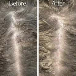 Hot Detox Clarifying Shampoo Hair Growth|Shampoo