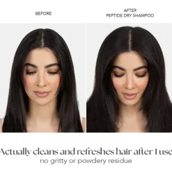 Outlet Dry Shampoo Haarprobleem|Shampoo