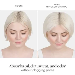 Outlet Dry Shampoo Haarprobleem|Shampoo