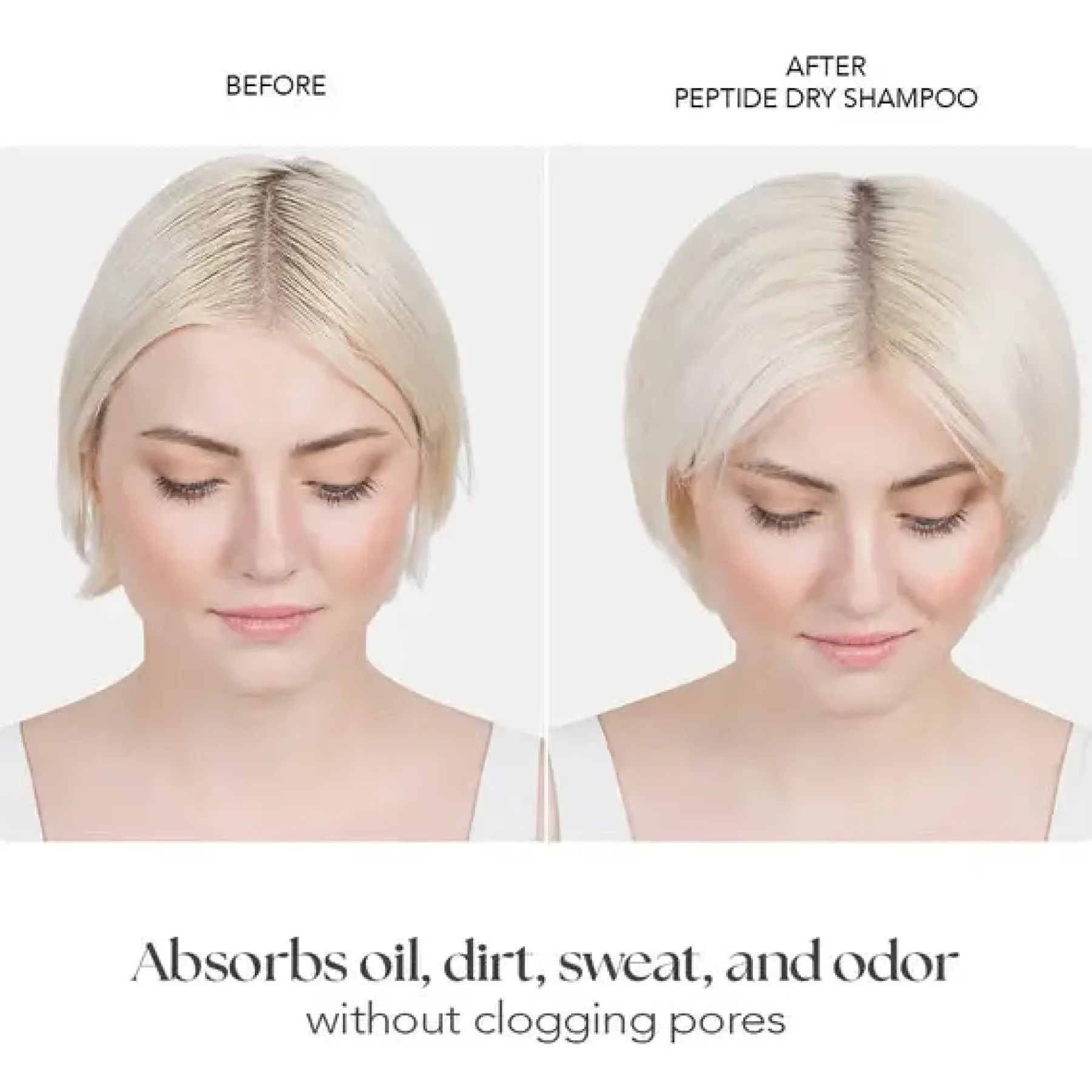 Outlet Dry Shampoo Haarprobleem|Shampoo