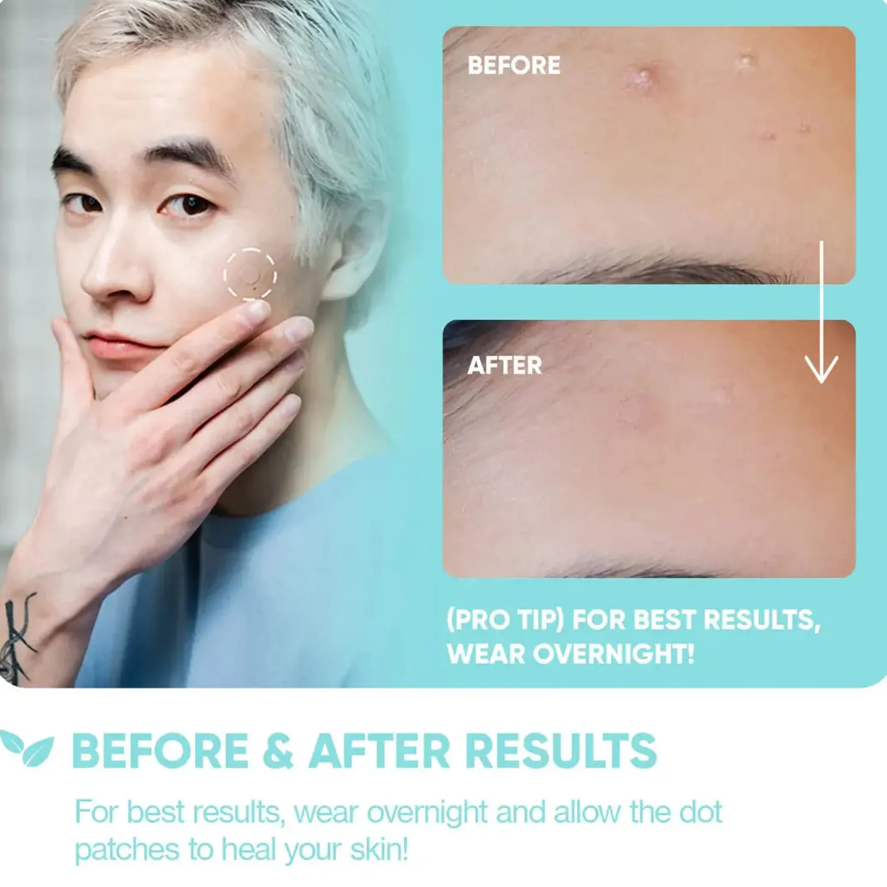 Sale Emergency Dots For Spots and Blemishes Tea Tree Oil Hauptzutat|Hautprobleme