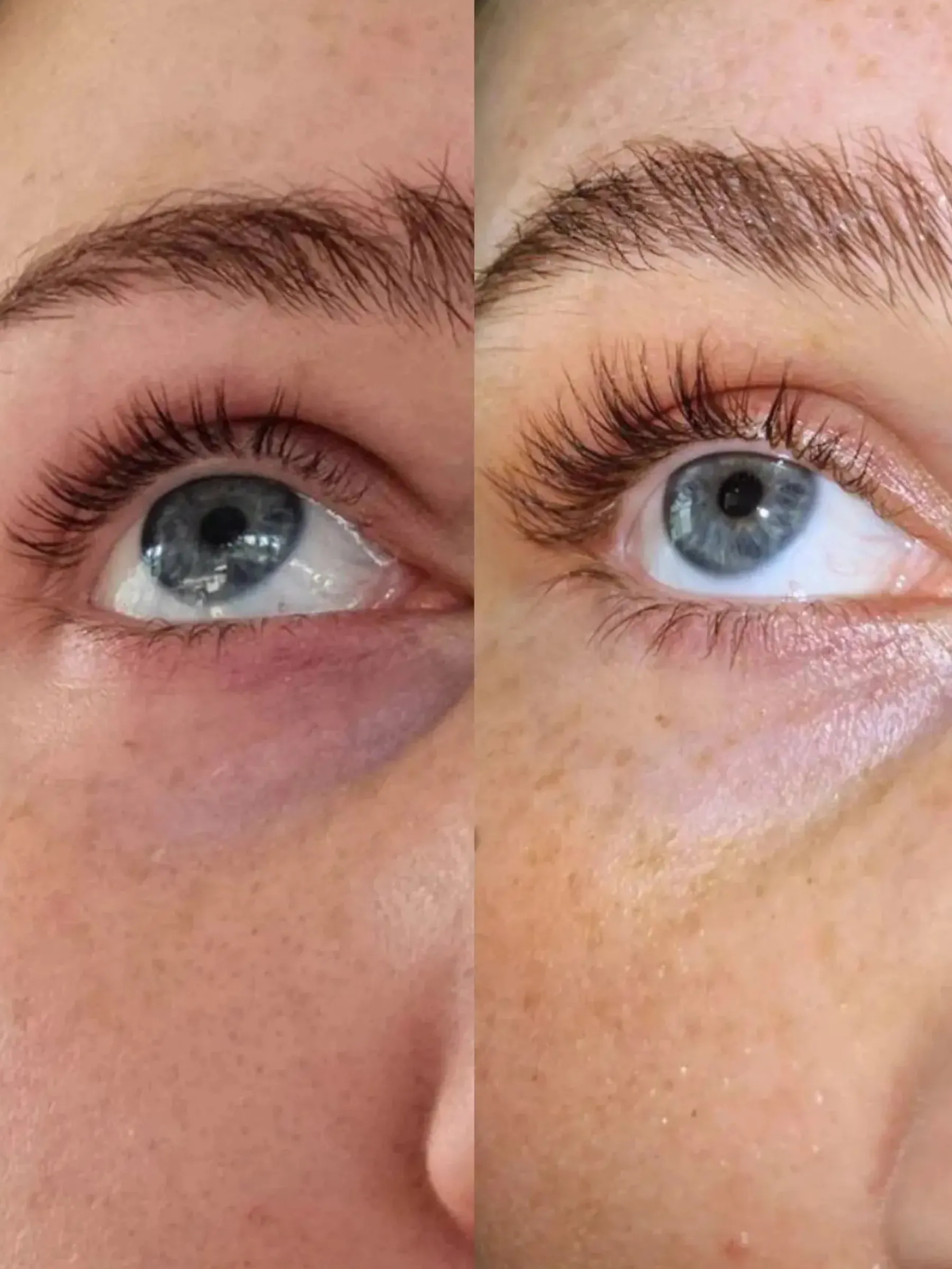 Online Eyelash Growth Serum Wimpernserum
