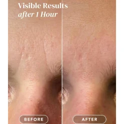 Best Facial Patches Hyaluron Vegan Pflege|Gesichtsmasken