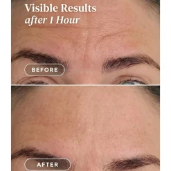 Best Forehead Pad Ectoin Gesichtsmasken|Hautprobleme