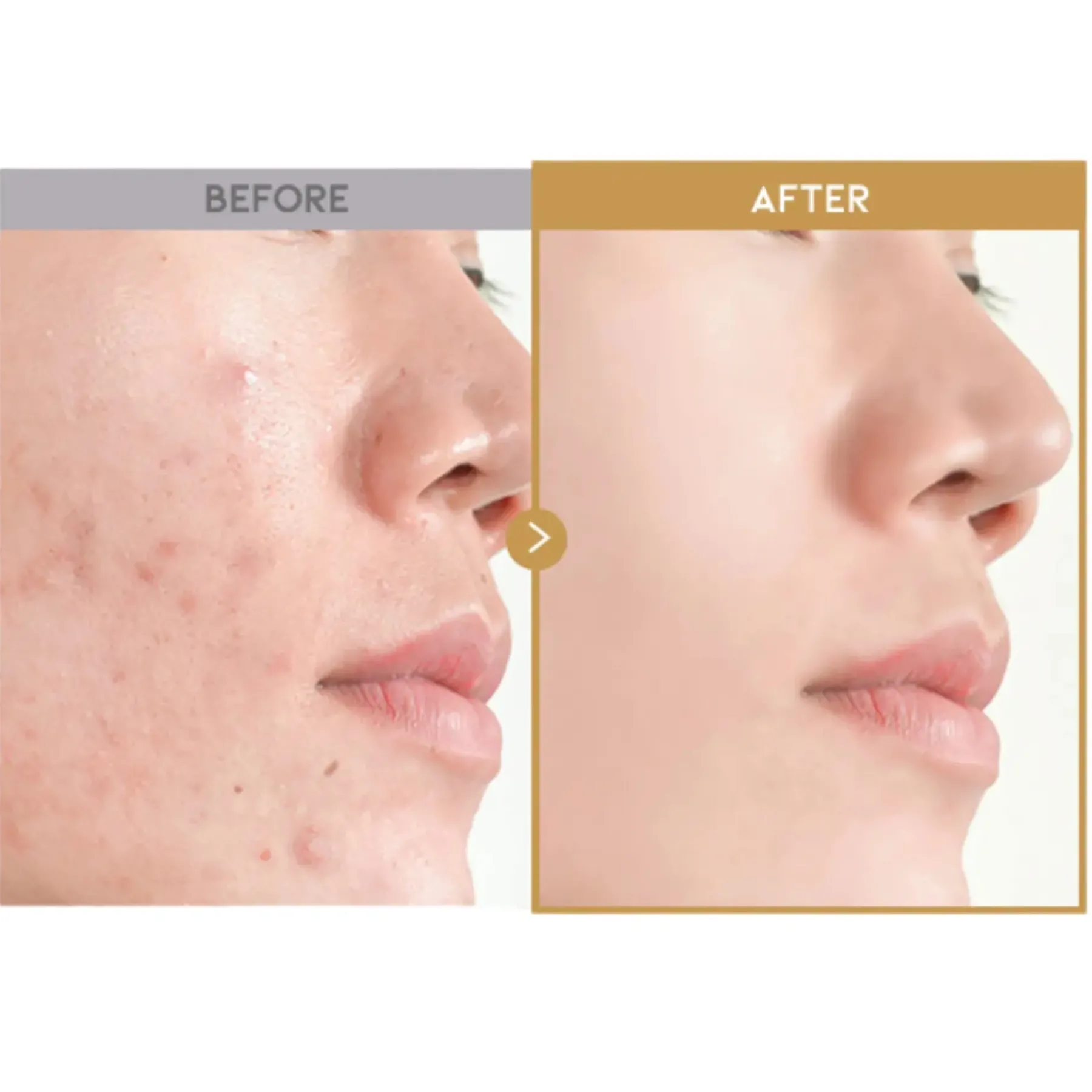 Best Glass Skin Rice Water Toner Pad Alle Korean Skincare|Toners