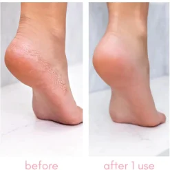 Best Heel-ing Callus Remover Vegan Pflege|Fußpflege