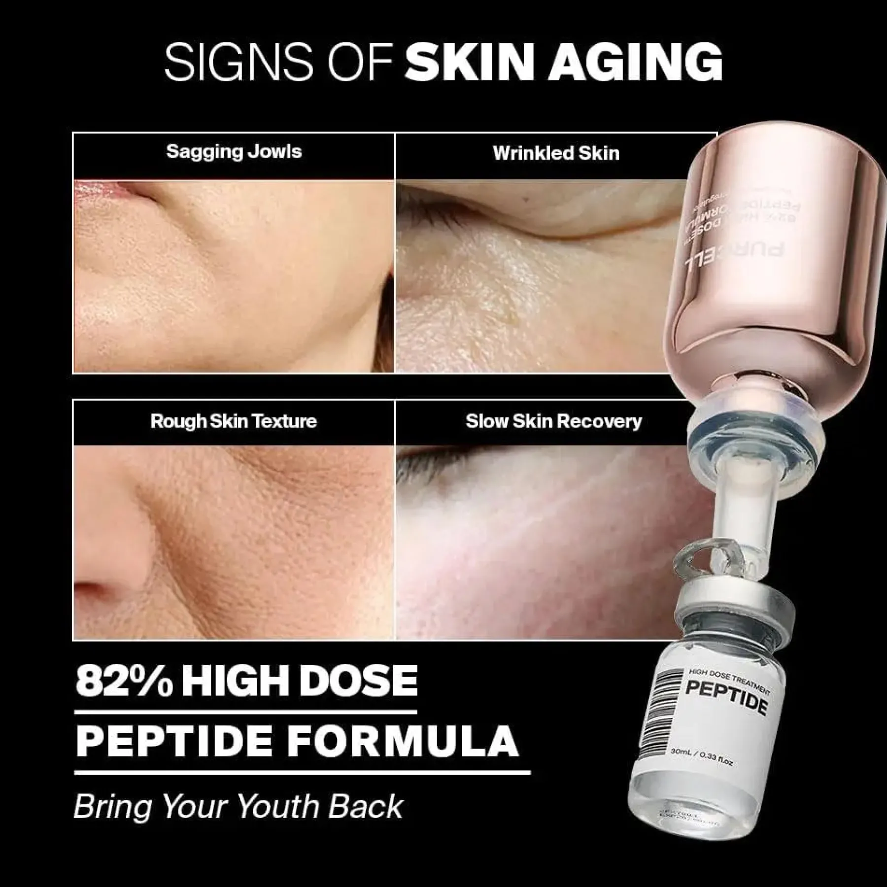 Online 82% High Dose Peptide Formula Hauptzutat|Anti-Unreinheiten-Serum