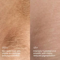Sale Hydrating Body Lotion Everything Shower|Hautprobleme
