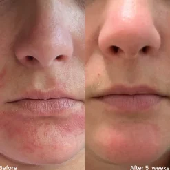 Hot Hydrating Moisturizer Feuchtigkeitscremes