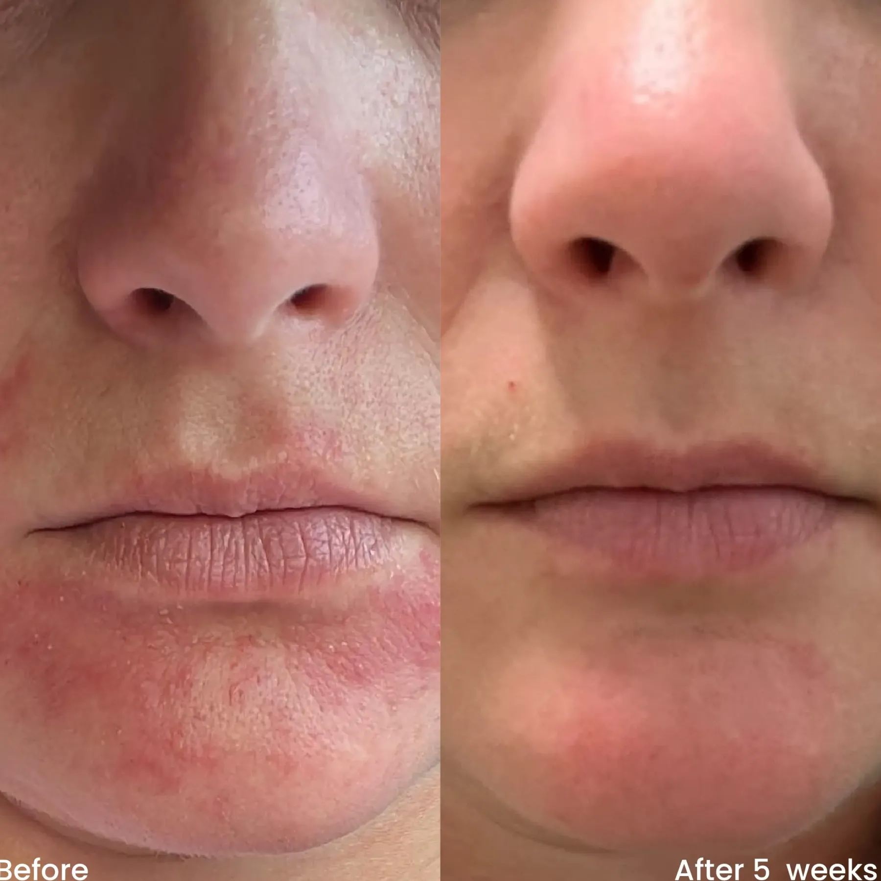 Hot Hydrating Moisturizer Feuchtigkeitscremes