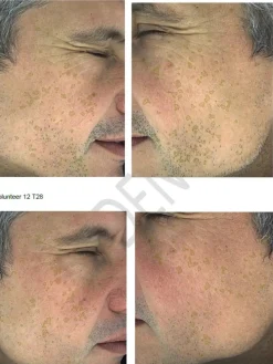 Hot Hyperpigmentation Serum - 2% Alpha Arbutin + 1% Kojic Acid Vegan Pflege|Problemlösende Seren