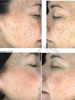 Hot Hyperpigmentation Serum - 2% Alpha Arbutin + 1% Kojic Acid Vegan Pflege|Problemlösende Seren