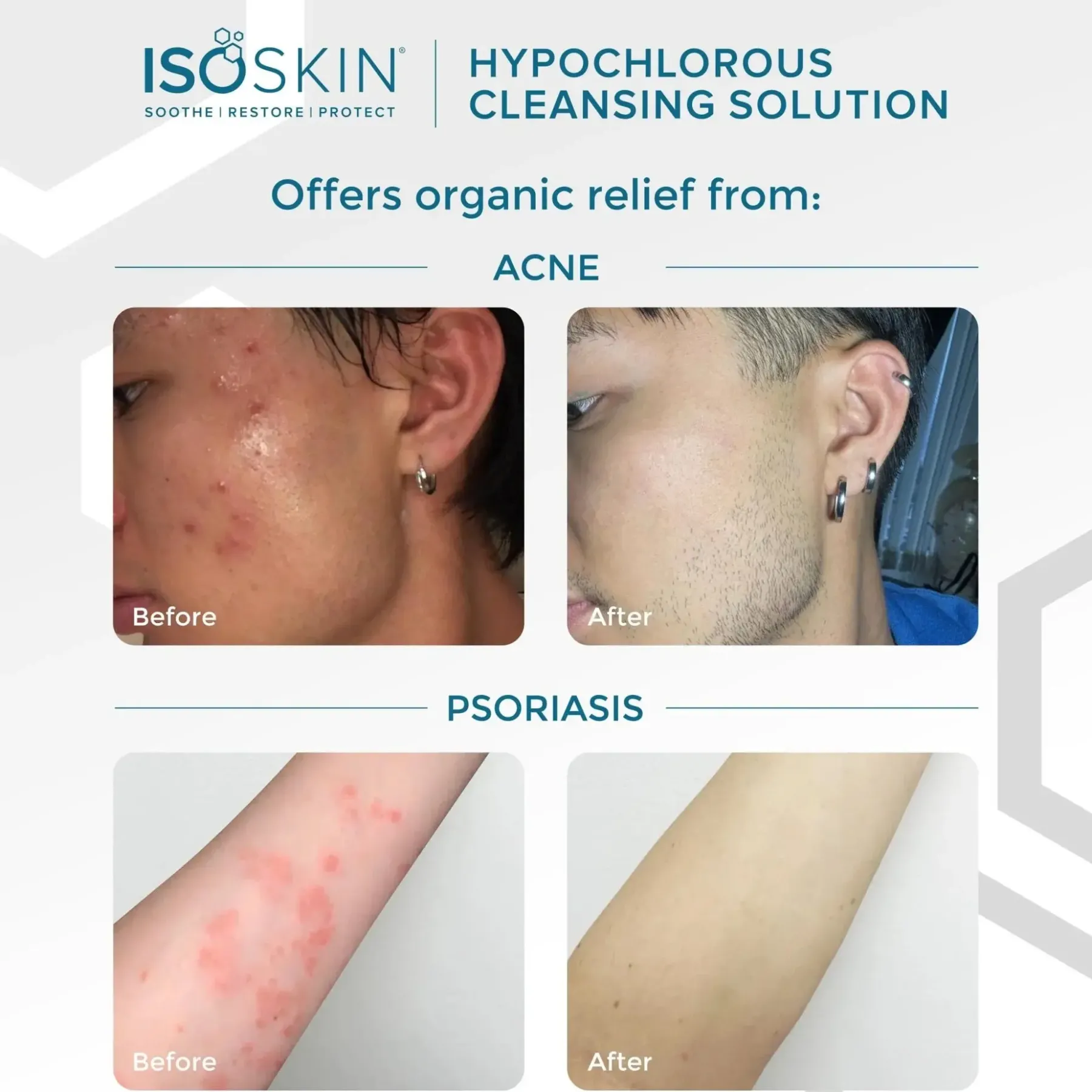 Online Hypochlorous Spray Vegan Pflege|Toners