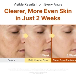 New Kojic Acid Niacinamide Brightening Ampoule Ampoules|Aufhellendes Serum