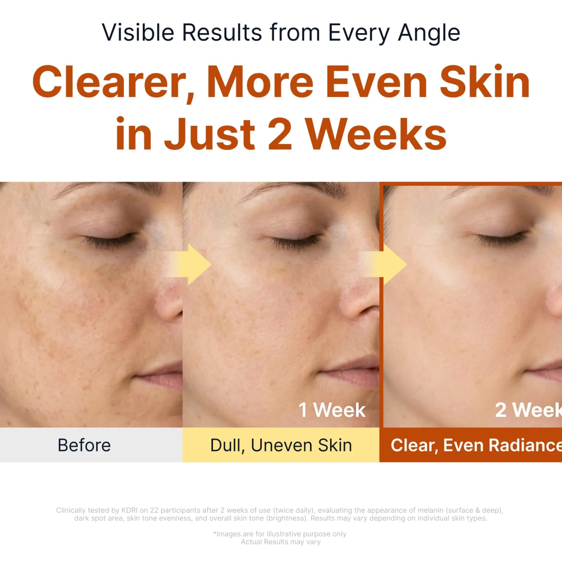 New Kojic Acid Niacinamide Brightening Ampoule Ampoules|Aufhellendes Serum