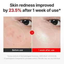 Online Madeca Cream Time Reverse Zero Feuchtigkeitscremes|Feuchtigkeitscremes