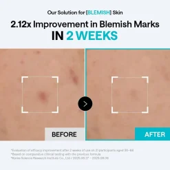 Discount Madecassoside Blemish Pad Hauptzutat|Toner Pads