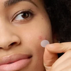 Mighty Patch The Original Alle Korean Skincare|Pickelpflaster