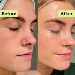 Online Moon Moisture Drops Face Oil Vegan Pflege|Problemlösende Seren