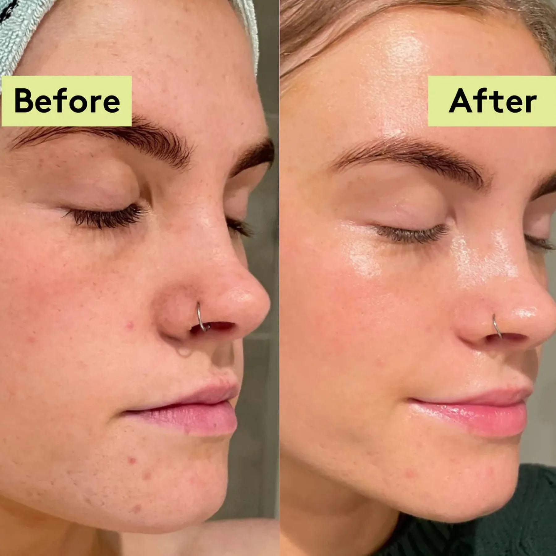 Online Moon Moisture Drops Face Oil Vegan Pflege|Problemlösende Seren
