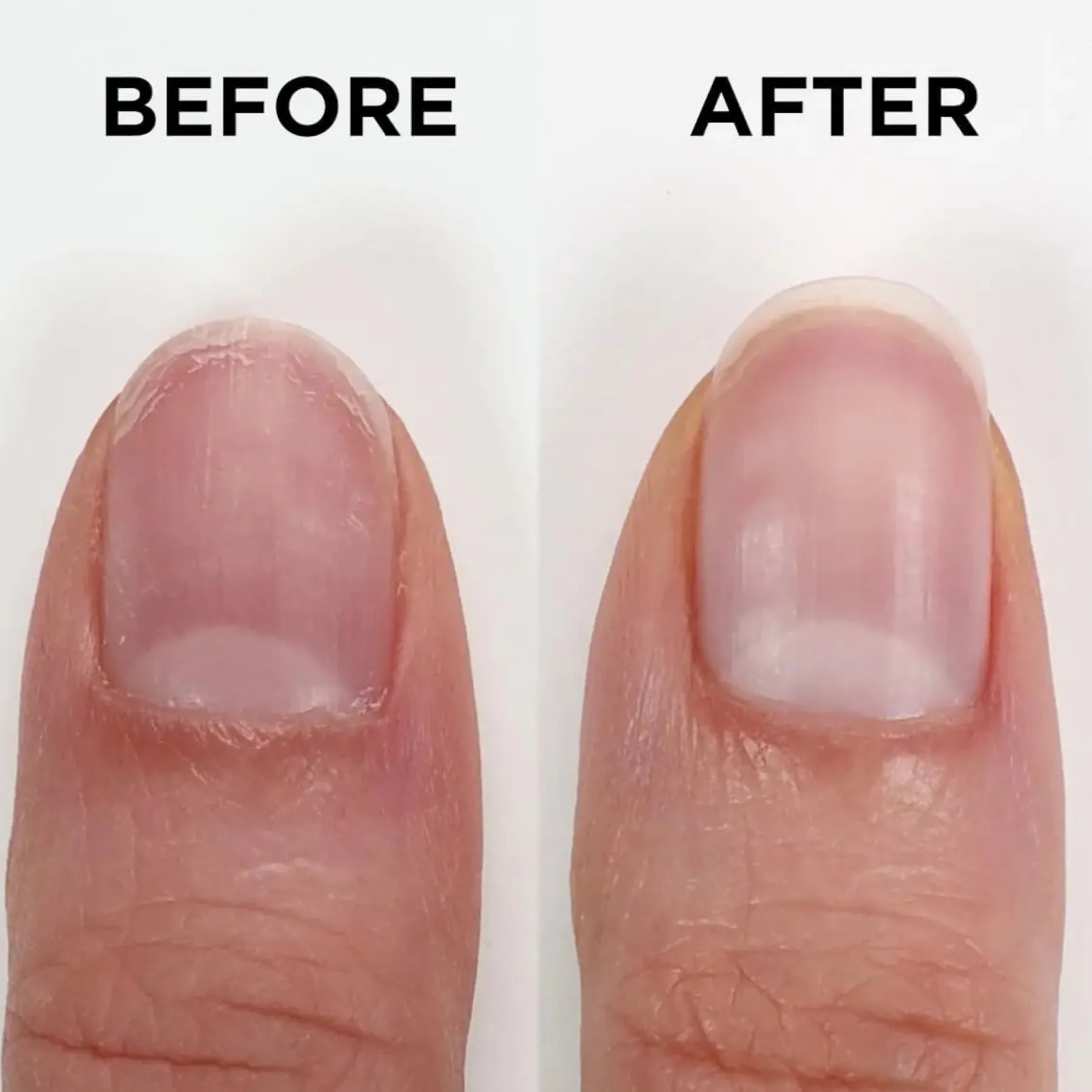 Best Nailtrition Nagelhärter
