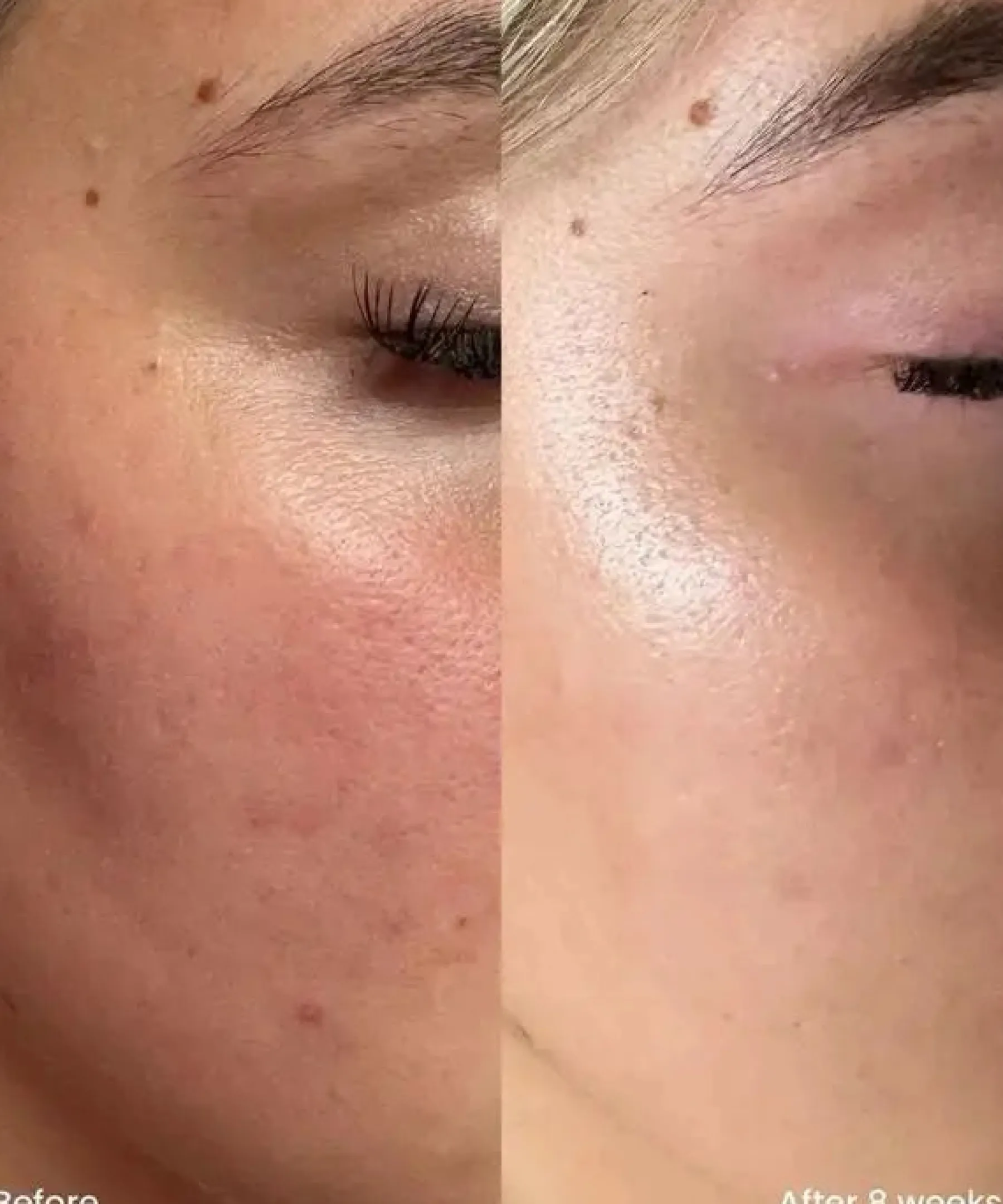 Outlet 10% Niacinamide Treatment Serum Vegan Pflege|Problemlösende Seren