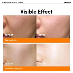 Outlet PDRN Bounce Ball Serum Alle Korean Skincare|Problemlösende Seren