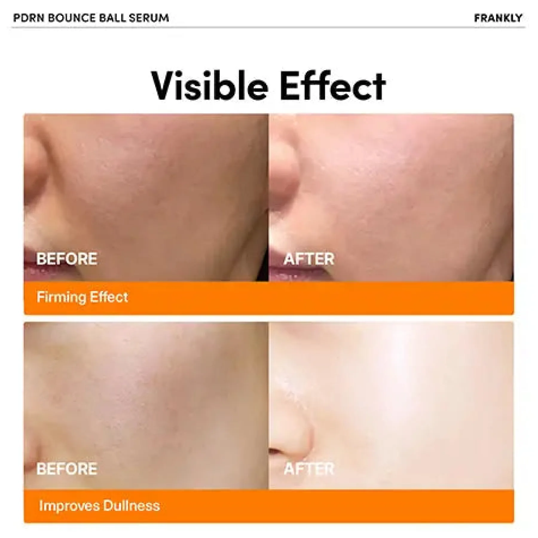 Outlet PDRN Bounce Ball Serum Alle Korean Skincare|Problemlösende Seren