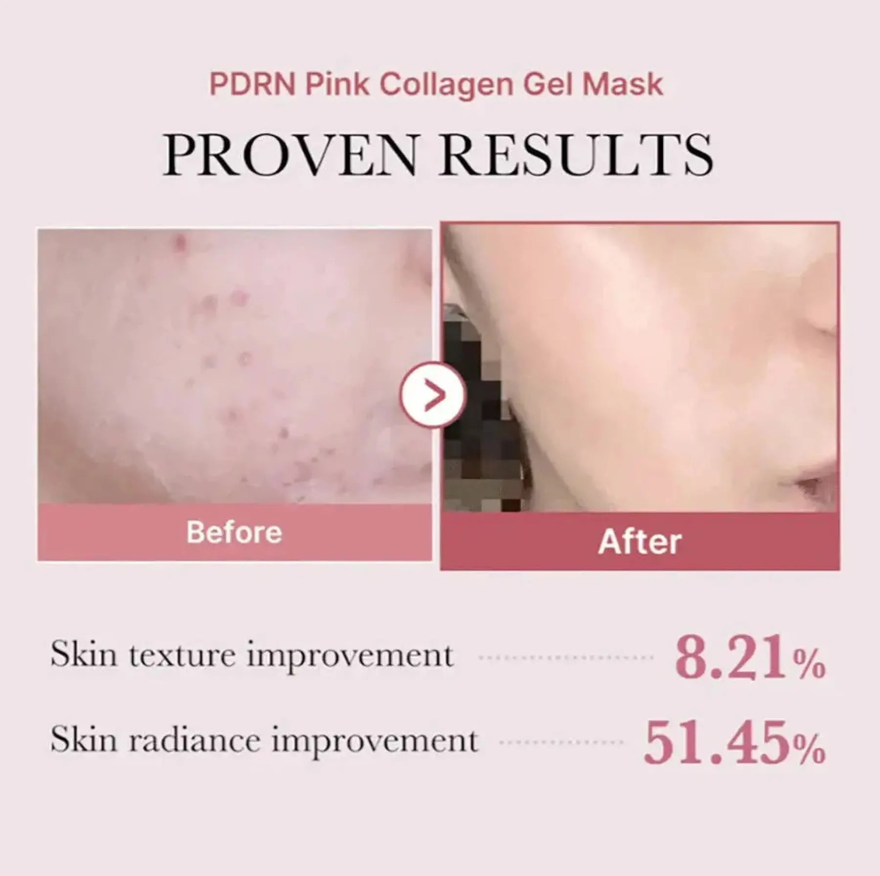 Hot Pdrn Pink Collagen Gel Mask 4-Pack Hauptzutat|Vegan Pflege