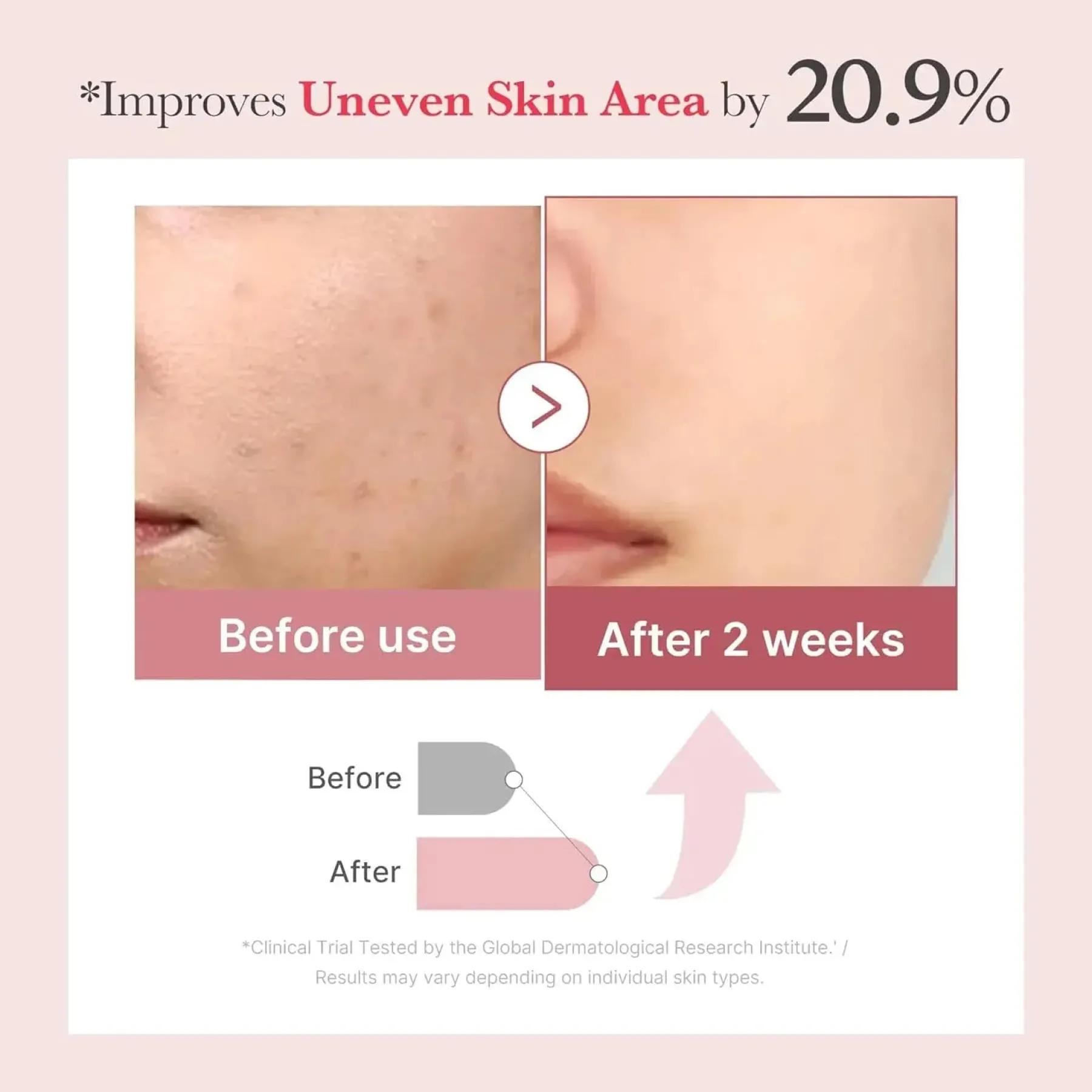 Sale PDRN Pink Exosome Shot Serum 7500 Hauptzutat|Problemlösende Seren